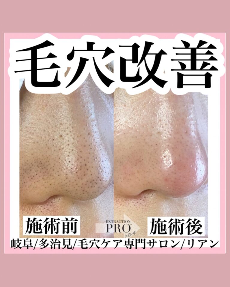 line_oa_chat_251123_230606 2