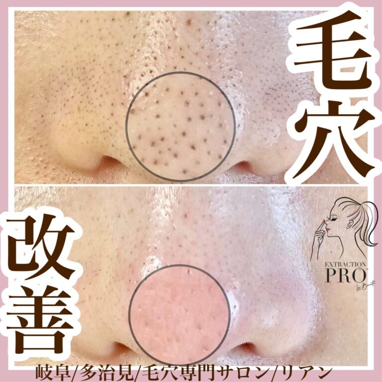 line_oa_chat_251123_230613 2