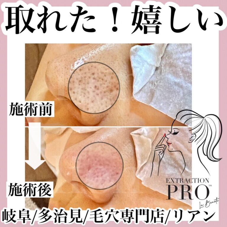 line_oa_chat_251123_230616 2