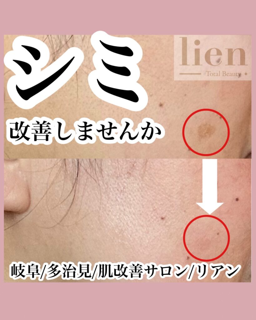 多治見 ｜毛穴・肌悩みに寄り添うフェイシャル専門店-lien-