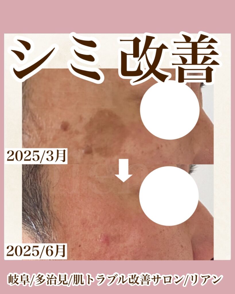 多治見 ｜毛穴・肌悩みに寄り添うフェイシャル専門店-lien-