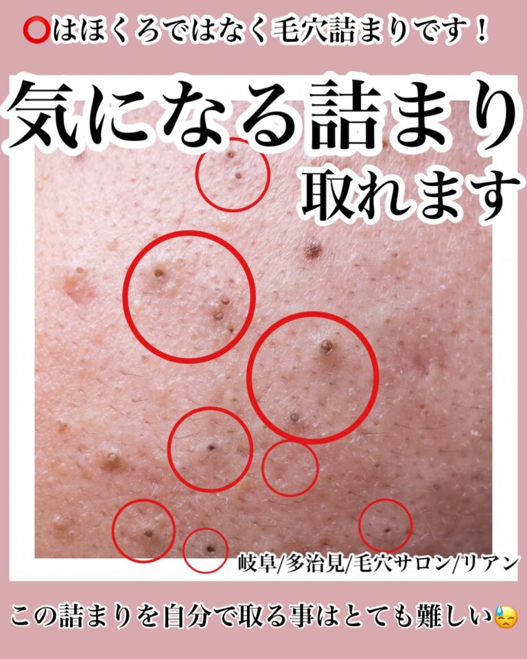 line_oa_chat_251123_230643 2